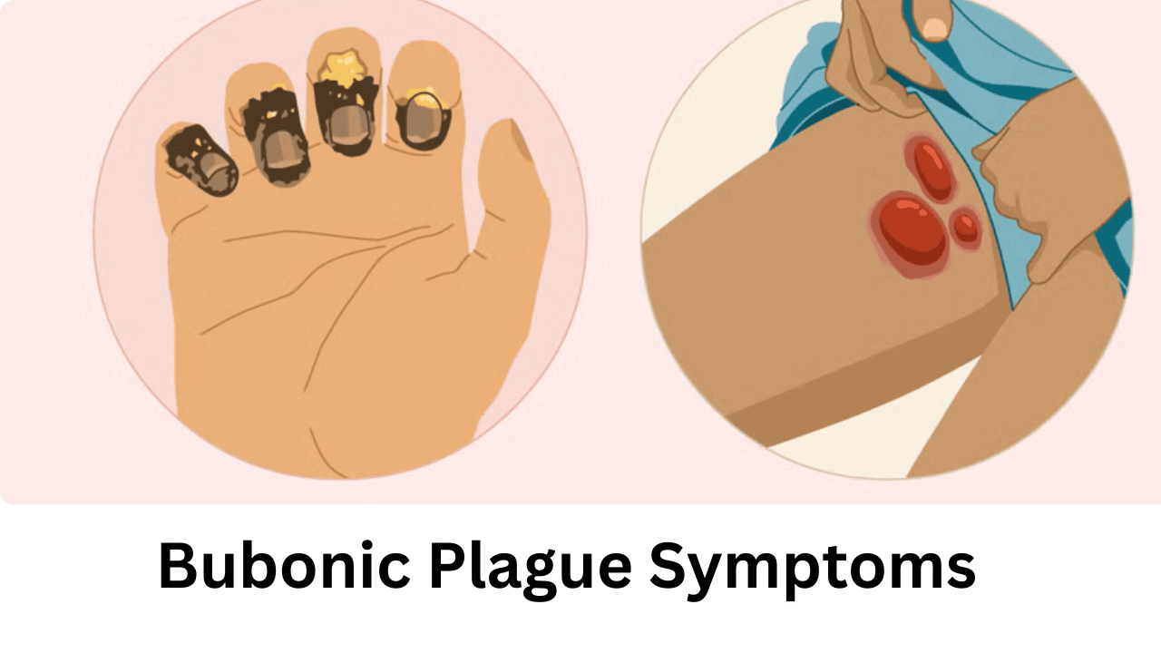 Bubonic Plague Symptoms: Early Warning Signs You Shouldn’t Ignore ...